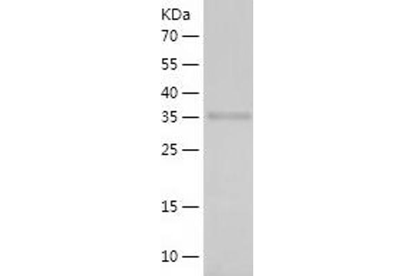 ROCK2 Protein (AA 1095-1388) (His tag)