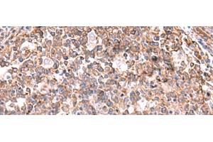 Immunohistochemistry of paraffin-embedded Human tonsil tissue using KBTBD11 Polyclonal Antibody at dilution of 1:35(x200) (KBTBD11 抗体)