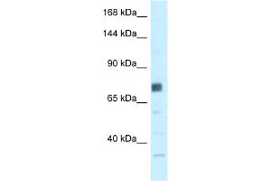 WB Suggested Anti-BRCA1 Antibody Titration: 0. (BRCA1 抗体  (N-Term))