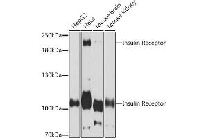 Western blot analysis of extracts of various cell lines, using Insulin Receptor Rabbit pAb (ABIN7267890) at 1:3000 dilution. (Insulin Receptor 抗体  (AA 1281-1382))