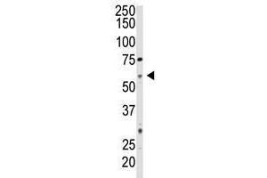 Image no. 1 for anti-5'-Nucleotidase, Ecto (CD73) (NT5E) (C-Term) antibody (ABIN357390) (CD73 抗体  (C-Term))