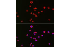 Immunofluorescence analysis of Neuro-2a cells using OPRK1 Rabbit pAb (ABIN6134089, ABIN6145043, ABIN6145045 and ABIN6218249) at dilution of 1:50 (40x lens). (OPRK1 抗体  (C-Term))