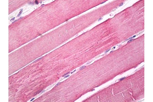 Myosin X 抗体  (Internal Region)