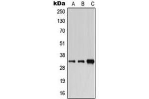Western blot analysis of Carbonic Anhydrase 6 expression in HEK293T (A), SP2/0 (B), H9C2 (C) whole cell lysates. (CA6 抗体  (C-Term))