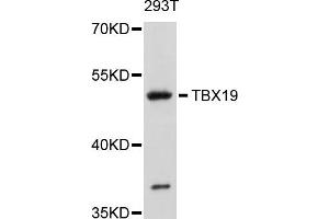 Western blot analysis of extracts of 293T cells, using TBX19 antibody. (T-Box 19 抗体)