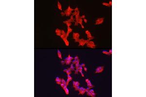 Immunofluorescence analysis of SH-SY5Y using R1 antibody (ABIN3023489, ABIN3023490, ABIN3023491 and ABIN6220077) at dilution of 1:50.