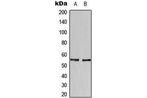 Western blot analysis of HBP1 expression in SKBR3 (A), U937 (B) whole cell lysates. (HBP1 抗体  (C-Term))