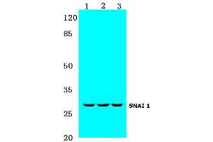 Western blot (WB) analysis of SNAI 1 antibody at 1/500 dilution: (SNAIL 抗体)