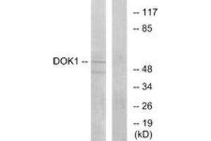 Western blot analysis of extracts from Jurkat cells, using p62 Dok (Ab-362) Antibody. (DOK1 抗体  (AA 329-378))