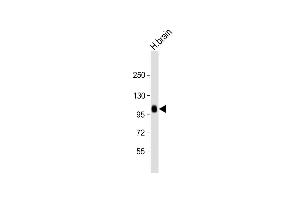 Anti-ADTS17 Antibody (N-term) at 1:2000 dilution + human brain lysate Lysates/proteins at 20 μg per lane. (ADAMTS17 抗体  (N-Term))