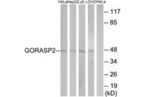 Western blot analysis of extracts from HeLa/HepG2/Jurkat/LOVO cells, using GORASP2 Antibody. (GORASP2 抗体  (AA 181-230))