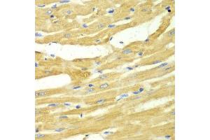 Immunohistochemistry of paraffin-embedded rat heart using OGT antibody at dilution of 1:100 (x40 lens). (OGT 抗体)