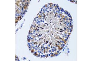 Immunohistochemistry (Paraffin-embedded Sections) (IHC (p)) image for anti-Inositol(myo)-1(or 4)-Monophosphatase 1 (IMPA1) (AA 1-277) antibody (ABIN6142429)