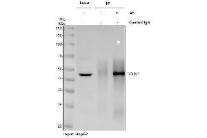 Immunoprecipitating (IP) TSG101 in HepG2 whole cell lysate.