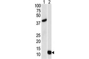 Western blot analysis of SUMO3 antibody and (1) GST-SUMO3 recombinant protein and (2) HL-60 lysate. (SUMO3 抗体)
