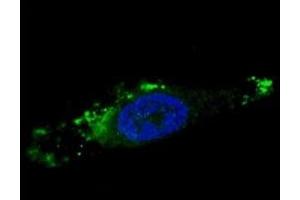 Fluorescent image of chloroquine-treated U251 cells stained with ATG12 antibody. (ATG12 抗体  (AA 1-30))