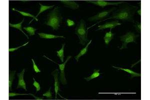 Immunofluorescence of monoclonal antibody to PURA on HeLa cell. (PURA 抗体  (AA 183-292))