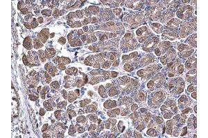 Immunohistochemistry (IHC) image for anti-Succinate-CoA Ligase, ADP-Forming, beta Subunit (SUCLA2) antibody (ABIN2856701)