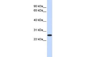 WB Suggested Anti-DULLARD Antibody Titration:  0. (CTDNEP1A 抗体  (Middle Region))