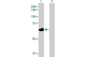 Western Blot analysis of DTNB expression in transfected 293T cell line by DTNB MaxPab polyclonal antibody. (Dystrobrevin beta 抗体  (AA 1-609))