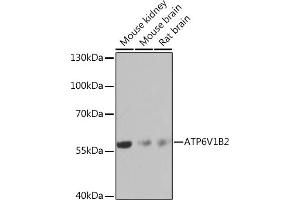 Western blot analysis of extracts of various cell lines, using V1B2 Rabbit pAb  at 1:1000 dilution. (ATP6V1B2 抗体  (AA 262-511))