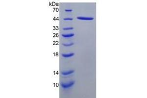 SDS-PAGE analysis of Rat SLC Protein. (CCL21 蛋白)