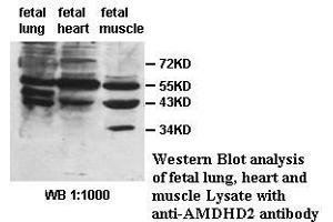 Image no. 1 for anti-Amidohydrolase Domain Containing 2 (AMDHD2) antibody (ABIN1574657) (AMDHD2 抗体)