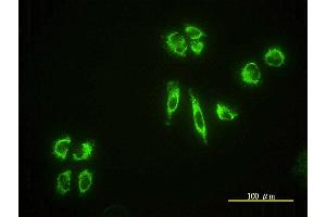 Immunofluorescence of monoclonal antibody to EHD4 on HeLa cell. (EHD4 抗体  (AA 1-541))