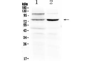 Western blot analysis of Dishevelled 2 using anti- Dishevelled 2 antibody . (DVL2 抗体  (N-Term))