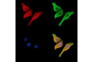 ABIN6259481 and ABIN6273812 staining Hela cells by IF/ICC.