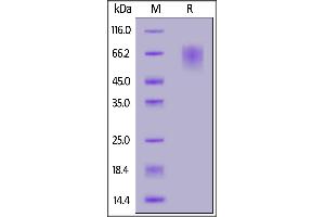 SDS-PAGE (SDS) image for SARS-CoV-2 Spike S1 (NTD) (Active) protein (His tag,AVI tag,Biotin) (ABIN6973252)