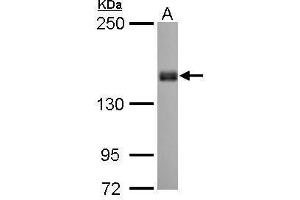WB Image Liprin alpha 1 antibody [N1N2], N-term detects PPFIA1 protein by Western blot analysis. (PPFIA1 抗体  (N-Term))