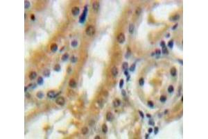 IHC-P analysis of Kidney tissue, with DAB staining. (Betacellulin 抗体  (AA 32-118))