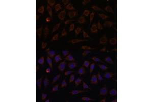 Immunofluorescence analysis of L929 cells using VILL antibody (ABIN7271325) at dilution of 1:100. (VILL 抗体  (AA 637-856))