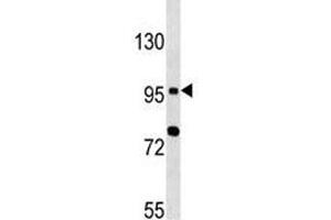 TLR6 antibody western blot analysis in MCF-7 lysate (TLR6 抗体  (AA 1-30))