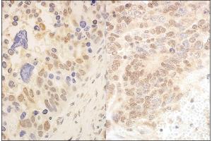 Immunohistochemistry (IHC) image for anti-Cullin 2 (CUL2) (AA 150-200) antibody (ABIN7453499)