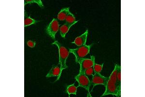 Immunofluorescence Analysis of MCF cells labeling Cytokeratin 8 withKRT8 Mouse Monoclonal Antibody (B22. (KRT8 抗体)