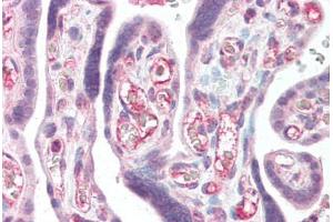 Immunohistochemistry (Paraffin-embedded Sections) (IHC (p)) image for anti-CASP8 and FADD-Like Apoptosis Regulator (CFLAR) (AA 191-209) antibody (ABIN461877)