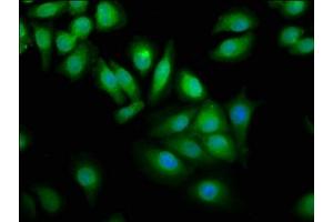 Immunofluorescence staining of A549 cells with ABIN7175871 at 1:100, counter-stained with DAPI. (WWOX 抗体  (AA 1-180))