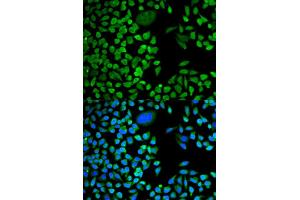 Immunofluorescence (IF) image for anti-TIA1 Cytotoxic Granule-Associated RNA Binding Protein (TIA1) antibody (ABIN1882364) (TIA1 抗体)