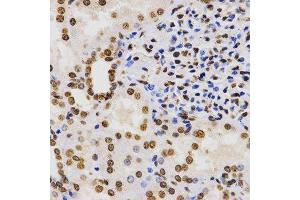 Immunohistochemistry (Paraffin-embedded Sections) (IHC (p)) image for anti-Histone 3 (H3) (H3K9me3) antibody (ABIN3016030)