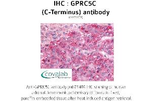 Image no. 1 for anti-G Protein-Coupled Receptor, Family C, Group 5, Member C (GPRC5C) (C-Term), (Cytoplasmic Domain) antibody (ABIN1735220) (GPRC5C 抗体  (C-Term, Cytoplasmic Domain))