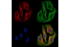 ABIN6255389 and ABIN6267301 staining H2O2 treated Hela cells by IF/ICC. (EIF2S1 抗体  (pSer51))
