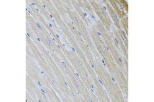 Immunohistochemistry of paraffin-embedded mouse heart using USP25 antibody at dilution of 1:100 (x40 lens). (USP25 抗体)