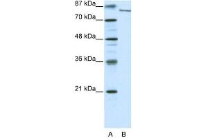 WB Suggested Anti-FBXL11 Antibody Titration: 0. (KDM2A 抗体  (N-Term))