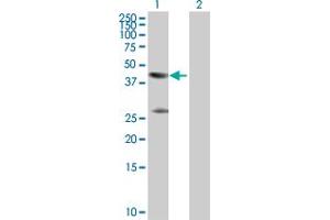 Western Blot analysis of CKM expression in transfected 293T cell line by CKM MaxPab polyclonal antibody. (CKM 抗体  (AA 1-381))