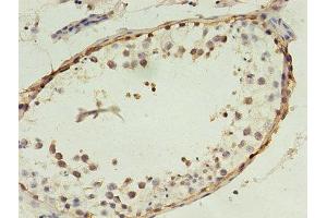 Immunohistochemistry of paraffin-embedded human testis tissue using ABIN7159264 at dilution of 1:100 (MAGEA4 抗体  (AA 1-270))