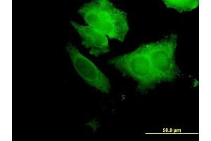 Immunofluorescence of purified MaxPab antibody to ECH1 on HeLa cell. (ECH1 抗体  (AA 1-328))