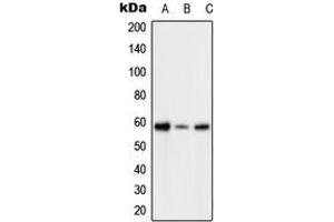 Western blot analysis of PFKFB2 (pS483) expression in HeLa H2O2-treated (A), SP2/0 H2O2-treated (B), H9C2 H2O2-treated (C) whole cell lysates. (PFKFB2 抗体  (C-Term, pSer483))