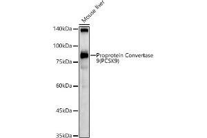 Western blot analysis of extracts of Mouse liver, using Proprotein Convertase 9(PCSK9) antibody (ABIN6133851, ABIN6145328, ABIN6145330 and ABIN6223837) at 1:1000 dilution. (PCSK9 抗体  (C-Term))